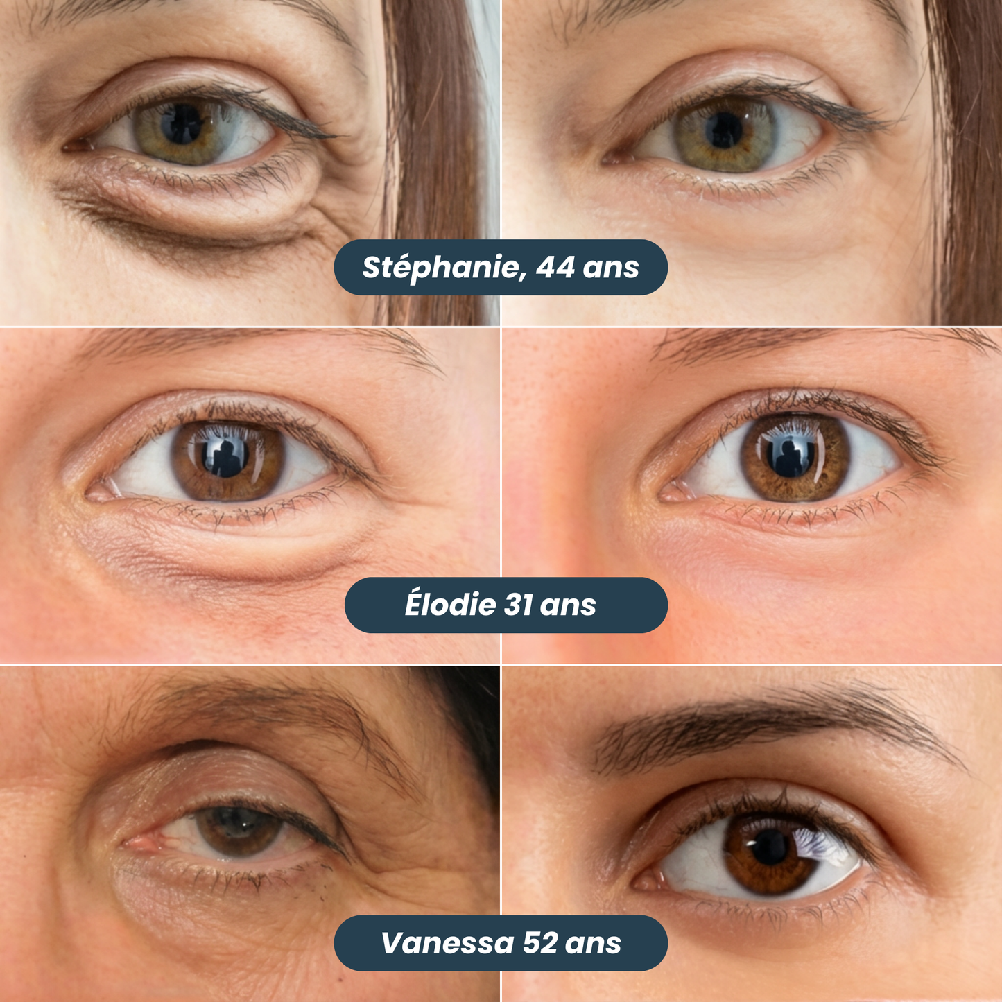 Patchs Anti-Cernes Nouvelle Génération